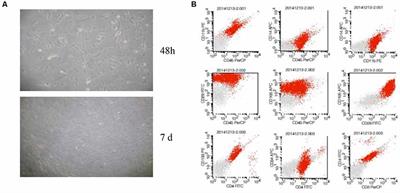 Isolation and Characterization of Neural Progenitor Cells From Bone Marrow in Cell Replacement Therapy of Brain Injury